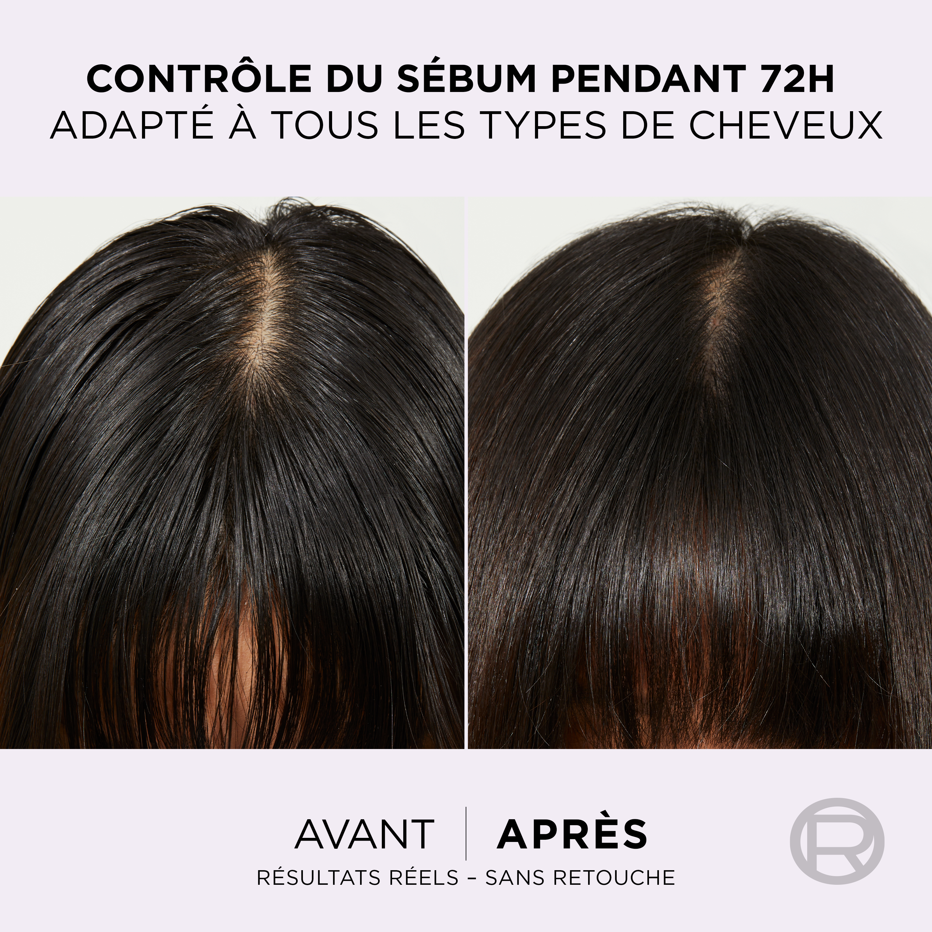 L'Oréal Paris - Sérum Purifiant Cuir Chevelu Gras - Élimine le Sébum & Purifie les Racines - Complexe Exfoliant à l'Acide Salicylique - Elseve Hyaluron Pure - 102 ml