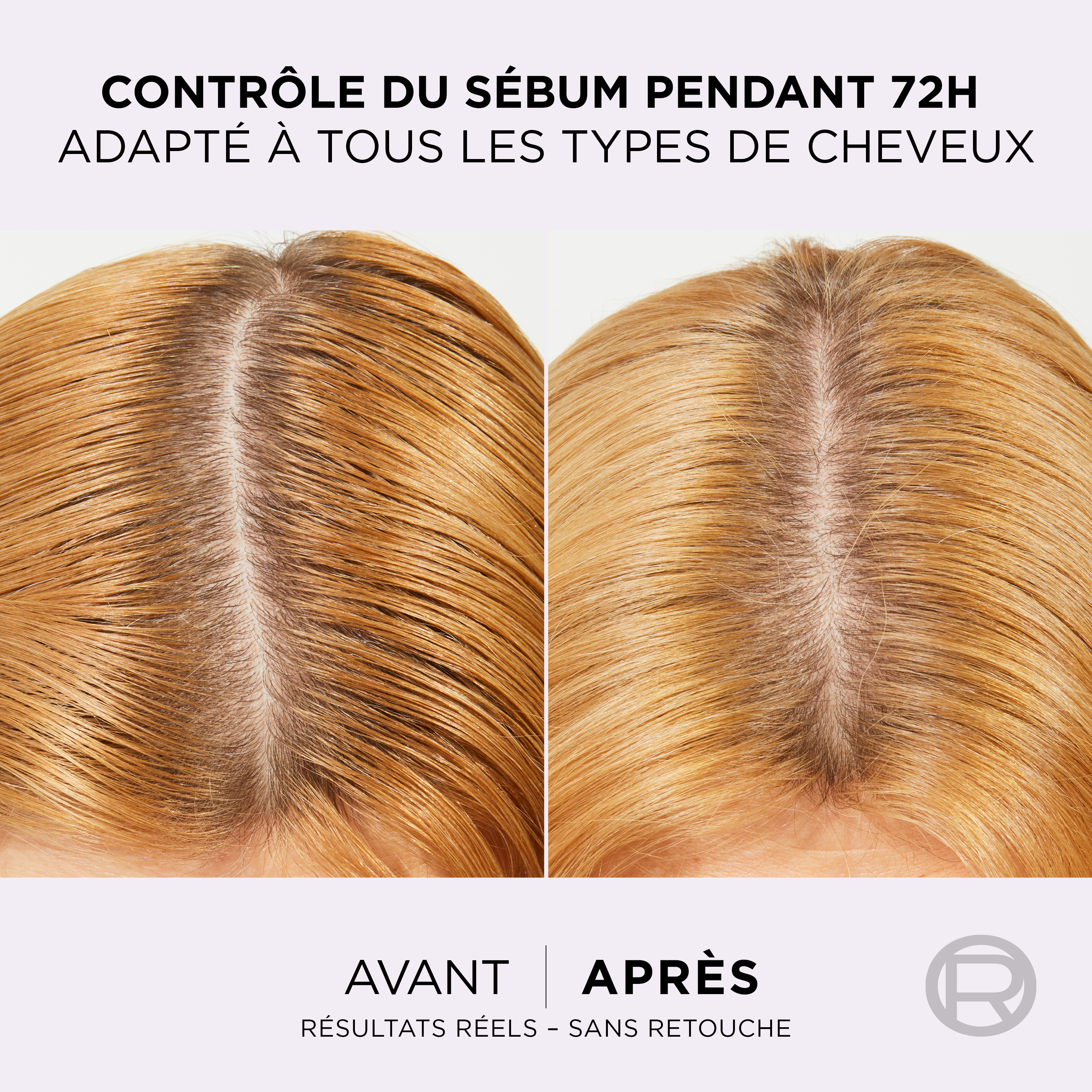 L'Oréal Paris - Sérum Purifiant Cuir Chevelu Gras - Élimine le Sébum & Purifie les Racines - Complexe Exfoliant à l'Acide Salicylique - Elseve Hyaluron Pure - 102 ml
