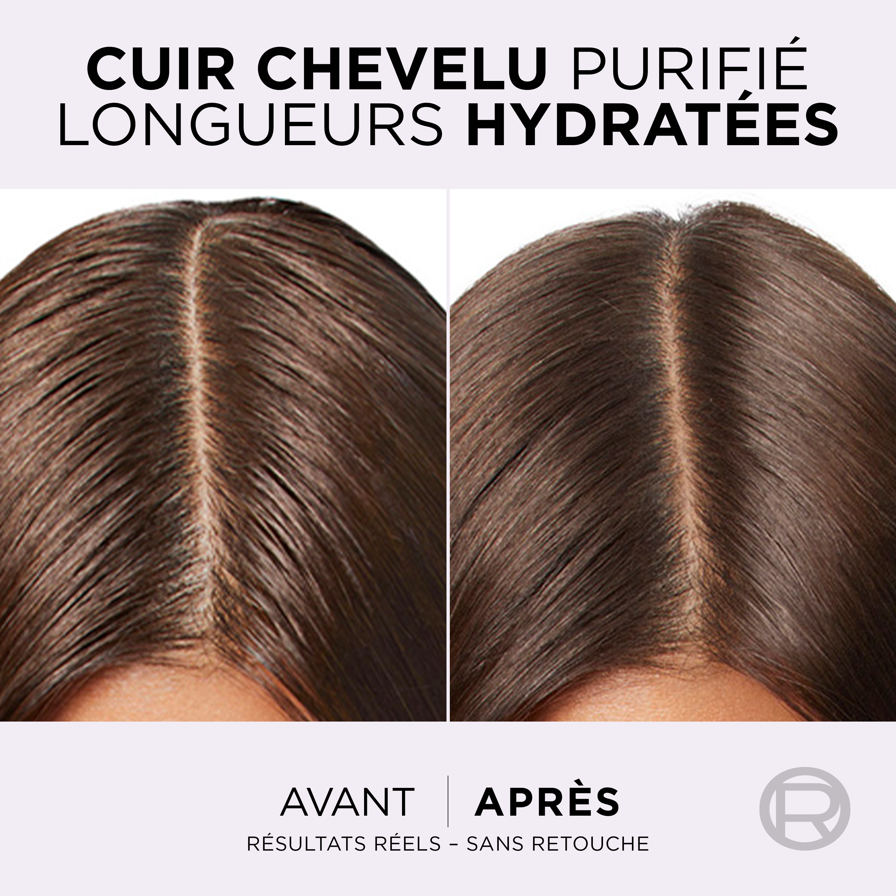 L'Oréal Paris - Sérum Purifiant Cuir Chevelu Gras - Élimine le Sébum & Purifie les Racines - Complexe Exfoliant à l'Acide Salicylique - Elseve Hyaluron Pure - 102 ml