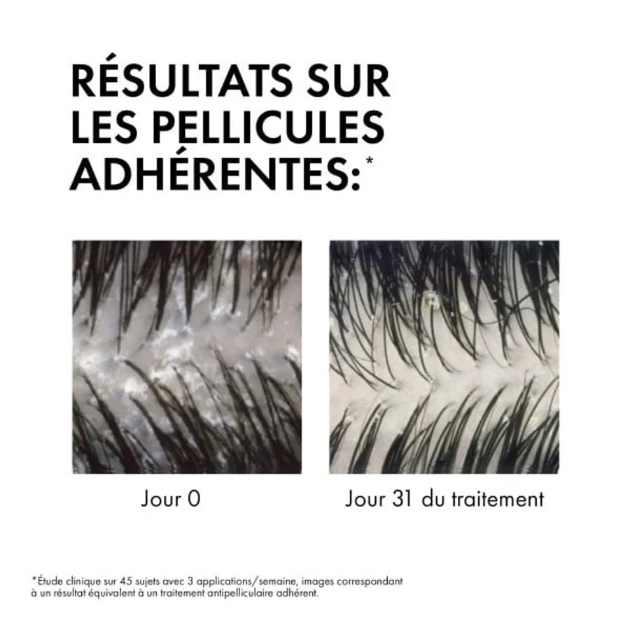 VICHY DERCOS SHAMPOOING ÉCO-RECHARGE ANTI-PELLICULAIRE DS - CHEVEUX SECS