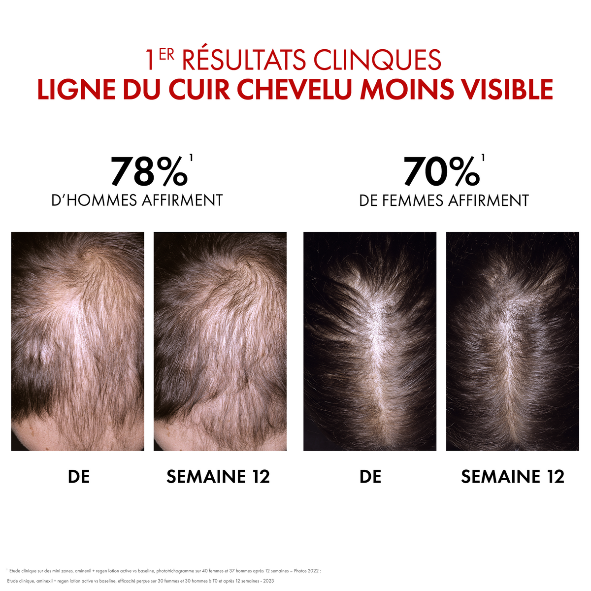 VICHY DERCOS DT AMINEXIL CLINICAL 5*21 FEMMES