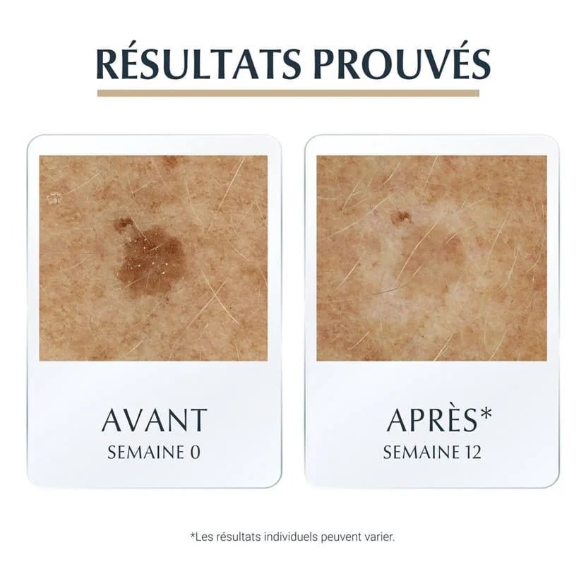 HYALURON FILLER + ELASTICITY 3D SERUM - 83566