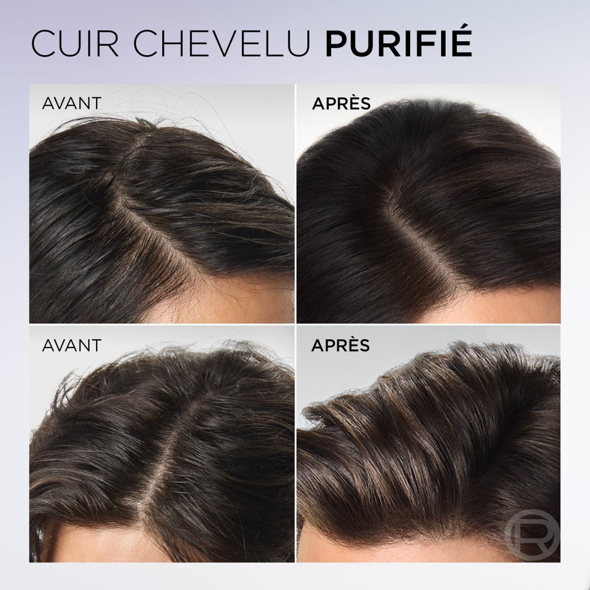 L'Oréal Paris Elseve Hyaluron Pure - Après Shampoing Demelant Rehydratant 72h - 200ml - L'Oréal Paris | BeautyForYou.ma
