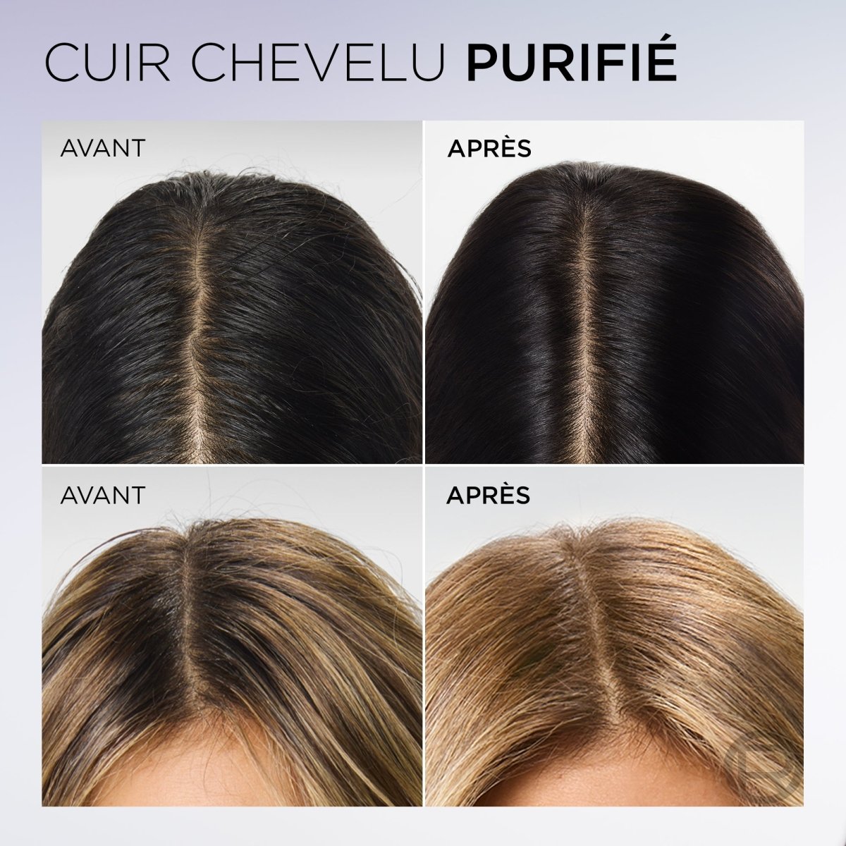 L'Oréal Paris Elseve Hyaluron Pure - Sérum Purifiant Cuir Chevelu Gras - 102 ml - L'Oréal Paris | BeautyForYou.ma