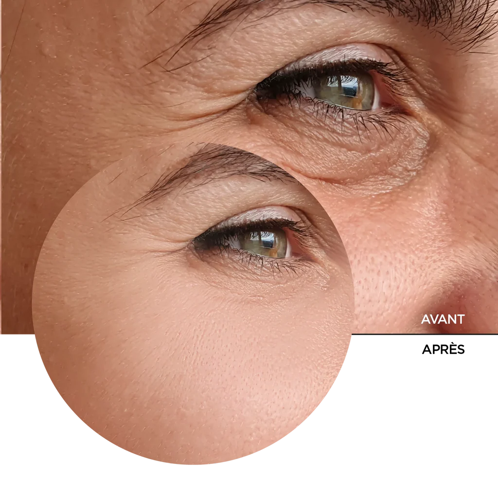 REVOX B77 JUST RETINAL 0.2% FLUID, 30 ml