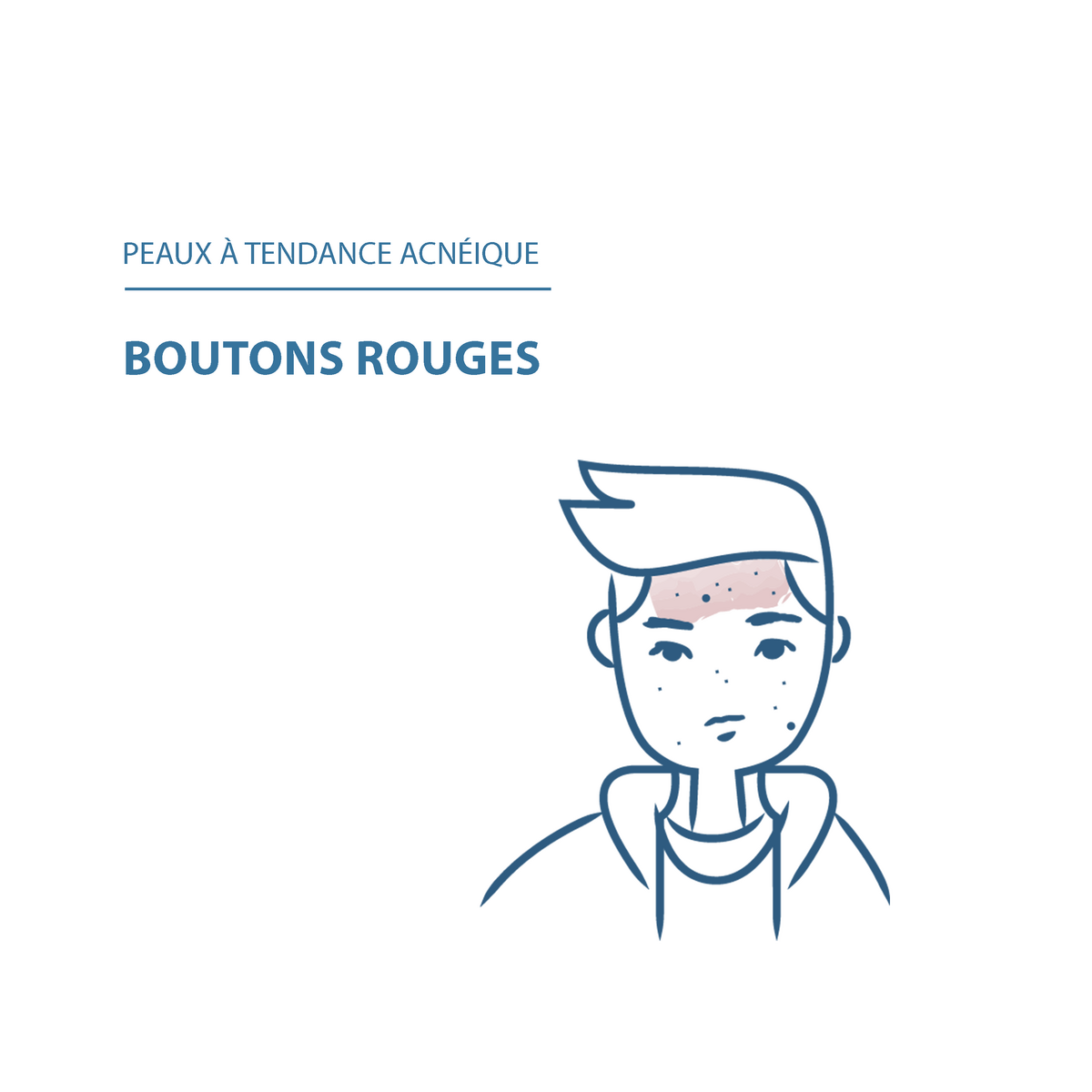 Ducray Soin anti-imperfections anti-récurrence KERACNYL PP+