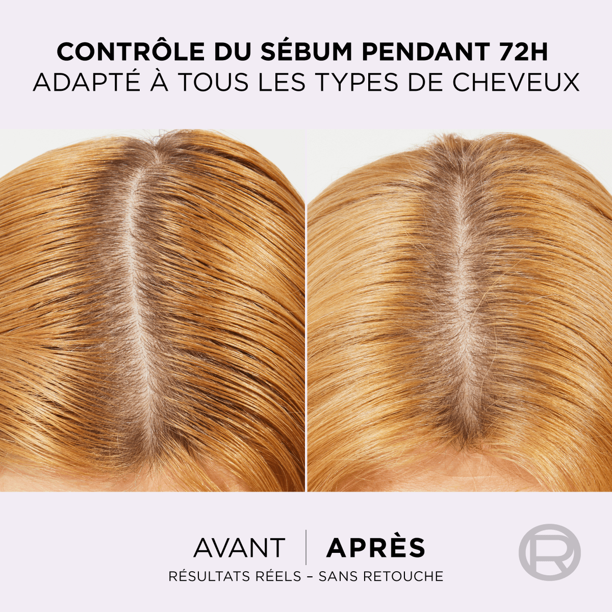 L'Oréal Paris - Shampooing Purifiant 72h pour Cuir Chevelu Gras - Complexe à l'Acide Salicylique et Hyaluronique - Protocole de Soin Capillaire - Elseve Hyaluron Pure - 300 ml* - 3610340670985