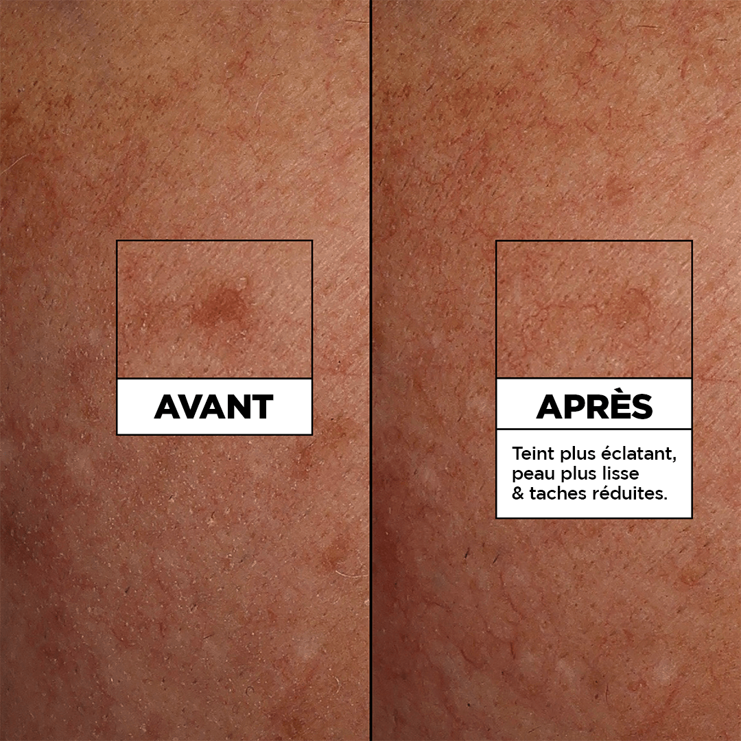 GARNIER FAST BRIGHT SERUM CLEANSER 100ML - Garnier | BeautyForYou.ma