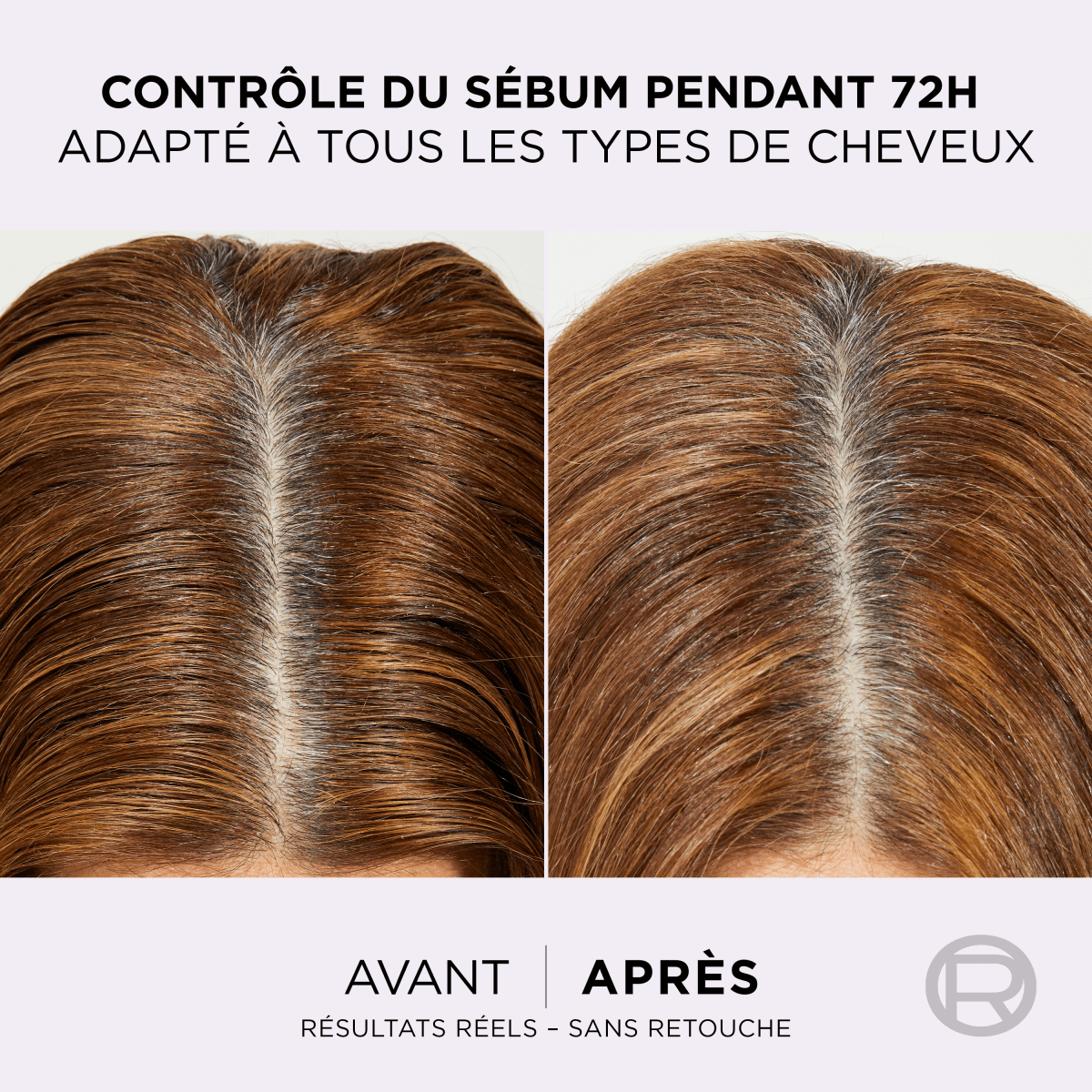 L'Oréal Paris - Sérum Purifiant Cuir Chevelu Gras - Élimine le Sébum & Purifie les Racines - Complexe Exfoliant à l'Acide Salicylique - Elseve Hyaluron Pure - 102 ml - 3600524135546