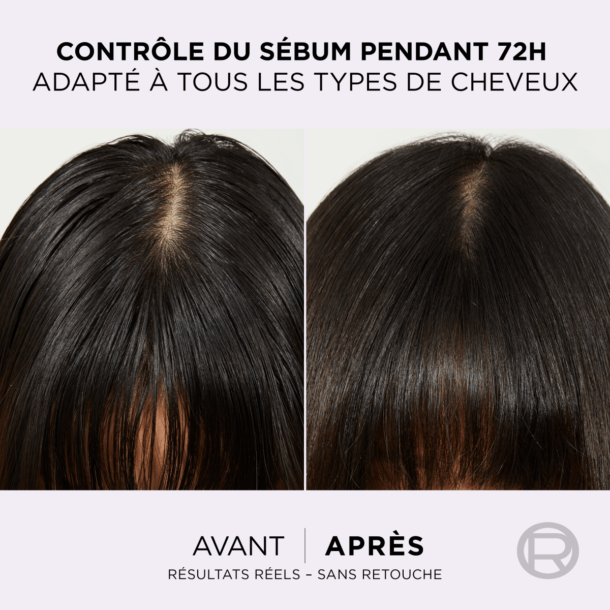 L'Oréal Paris - Shampooing Purifiant 72h pour Cuir Chevelu Gras - Complexe à l'Acide Salicylique et Hyaluronique - Protocole de Soin Capillaire - Elseve Hyaluron Pure - 200 ml - 3610340671005