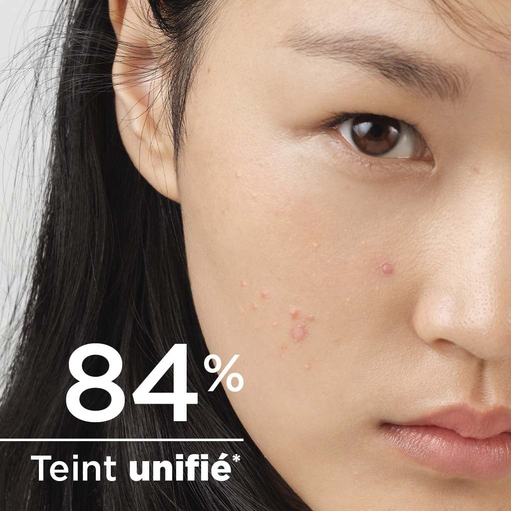 SEBIUM GLOBAL 30ML - 3050016