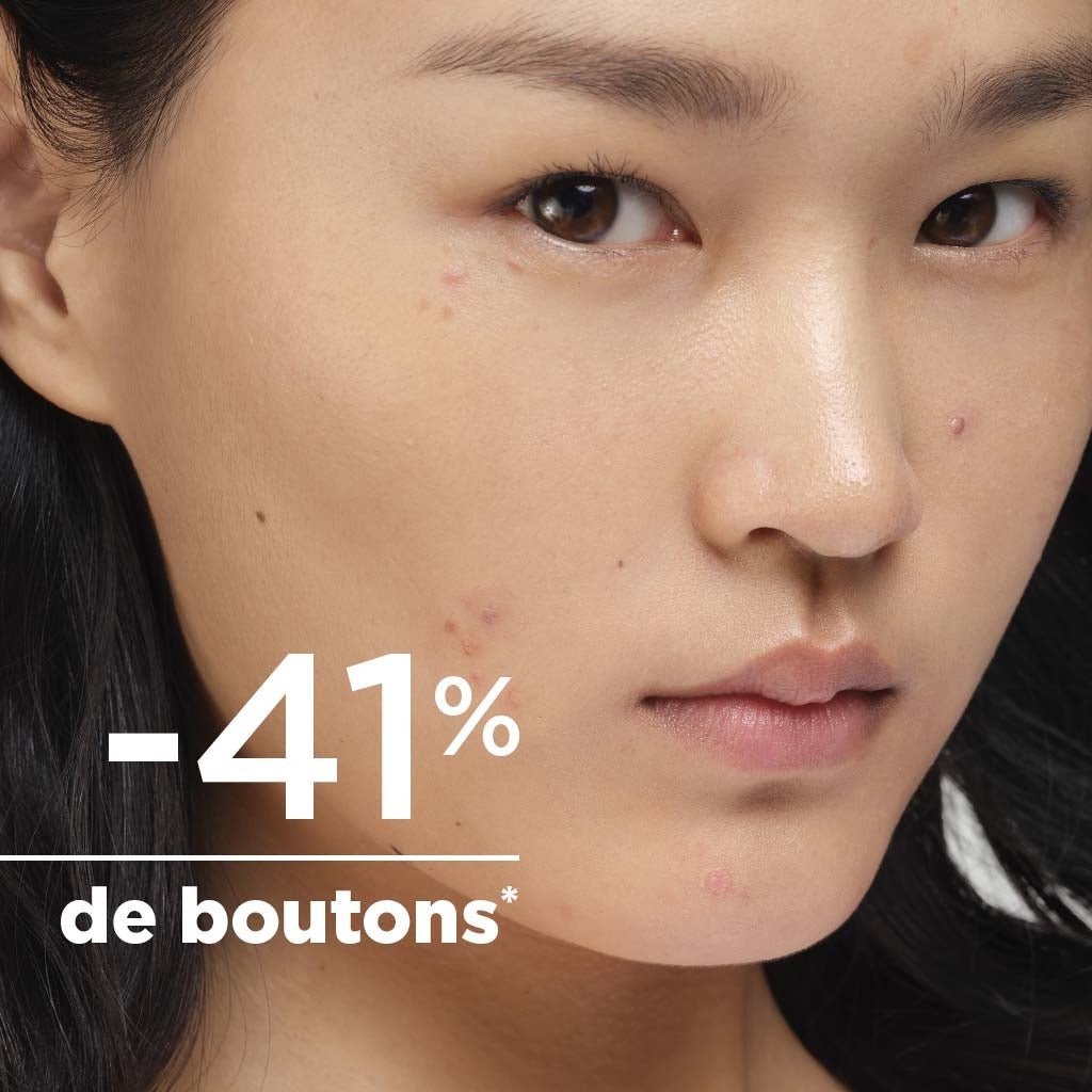 SEBIUM KERATO+ 30 ML - 3050029