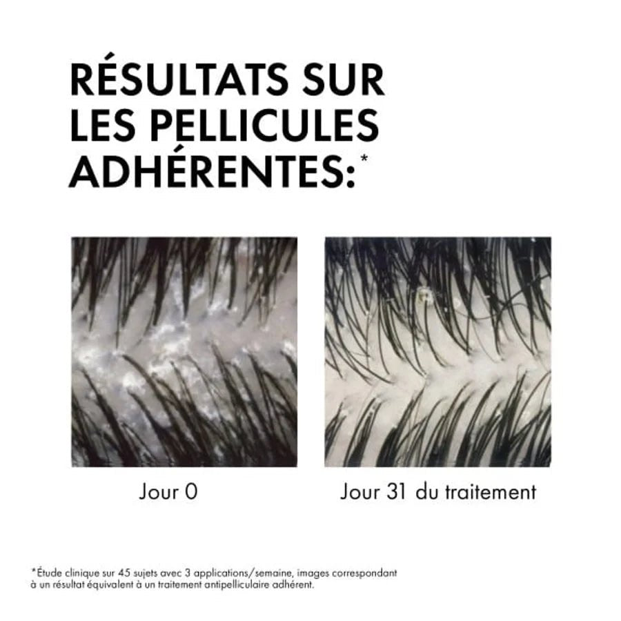 VICHY DERCOS SHAMPOOING ÉCO-RECHARGE ANTI-PELLICULAIRE DS - CHEVEUX SECS - Vichy Dercos | BeautyForYou.ma